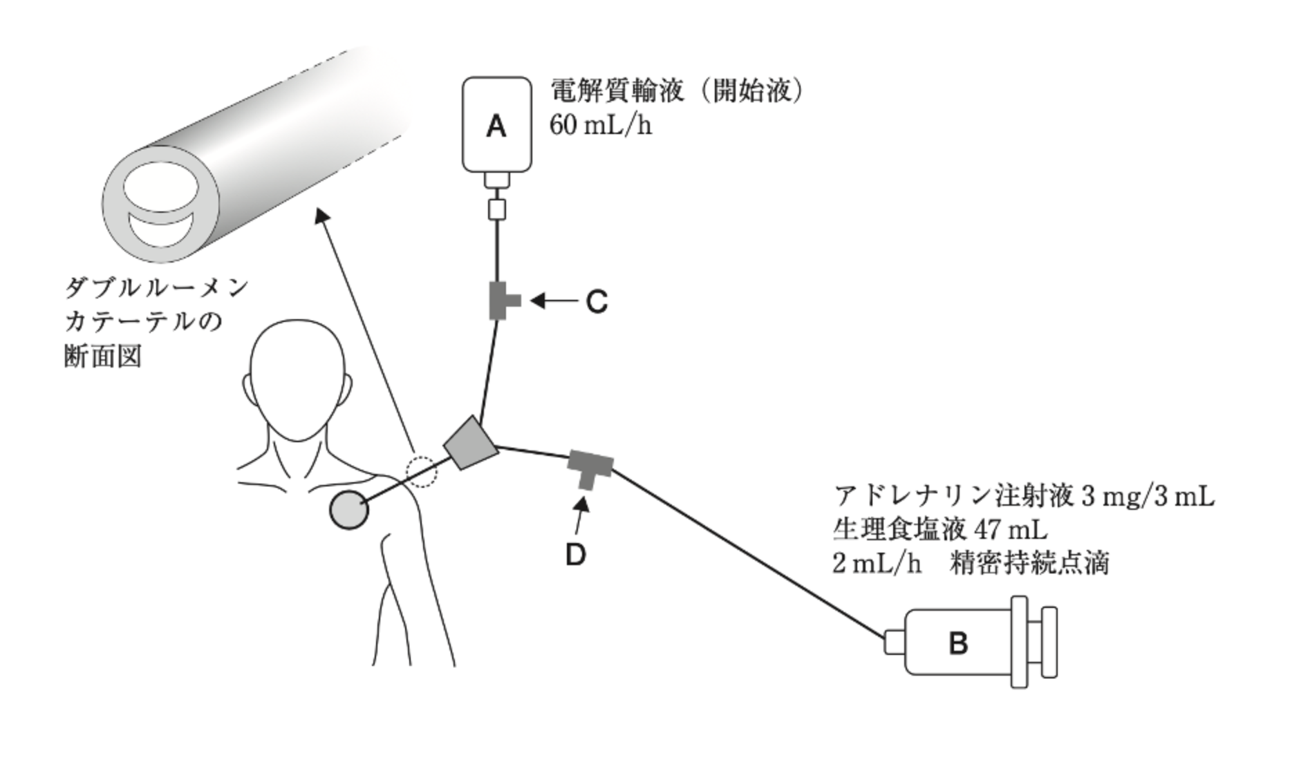 解説画像